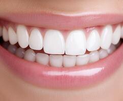 Bright, healthy smile with perfect teeth in natural lighting photo