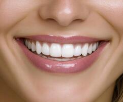 Bright and radiant smile of a young woman with perfect teeth photo