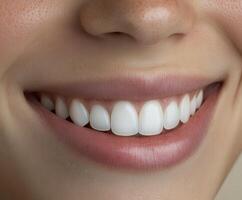 Close-up of a woman smiling with bright, white teeth in natural light photo