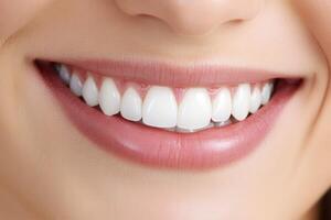 Close-up of a bright smile with healthy teeth during daylight hours photo