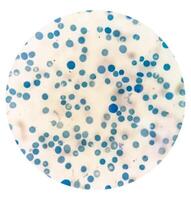 Close microscopic view of abnormal reticulocyte count in hematology department, photo