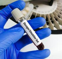 Glucagon Stimulation Test, Hypoglycemia a condition in which your glucose levels are lower than normal photo