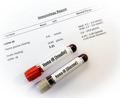 HOMA or Homeostatic Model Assessment Index or HOMA-IR test is a blood test used to diagnose a person's insulin resistance level. photo