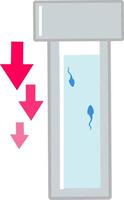 Poor low sperm analysis count for ivf procedure conceptual illustration of the mciroscope and sperm cells. Fit to show step by step of ivf procedure vector
