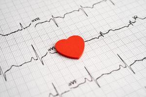 Electrocardiogram ECG graph paper with red heart, heart wave, heart attack, cardiogram report. photo