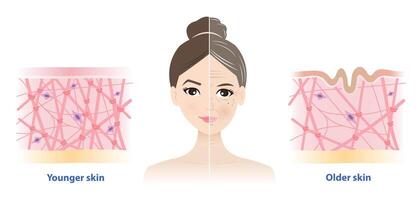 The difference between young and aging skin on woman face illustration. Aging process comparison. Cross section of high and low density of collagen, elastin fibers and fibroblasts in dermis. vector