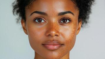Close-up of African American woman's face showing before and after freckles, highlighting skin texture. photo
