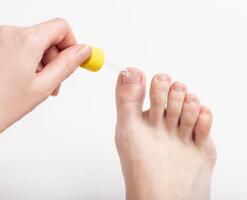 Application of a cosmetic product to the toenail to strengthen the nail and cuticle, vitamin complex. Copy space for text, inflammation photo