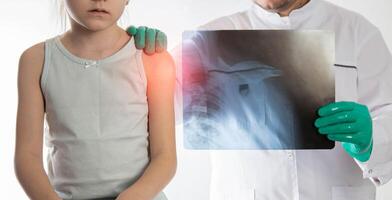 The hands of a doctor orthopedic traumatologist in green gloves holds an x-ray of a girl with a dislocated shoulder and a fracture of the shoulder. Trauma and sprain, close-up photo