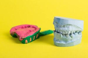 Dental spoon with alginate plastic mass for taking an impression of the dental jaw on a yellow background. Blue plaster dental jaw on a yellow background. Orthodontics in dentistry photo
