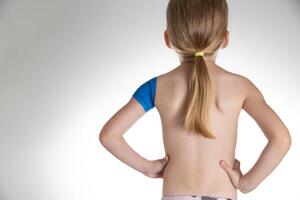 Blue elastic bandage on the shoulder joint, white background. Sprain in the shoulder in a child, treatment. Copy space for text photo