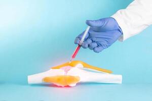 A doctor, with help from a syringe, injects the patient's blood plasma into a mock-up of the knee joint on a blue background. Kotsnept is a modern method of treating knee joints, plasma therapy. photo