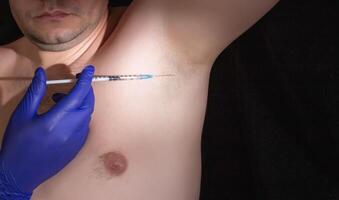 treatment of hyperhidrosis in a man with armpits. Sweating concept, close-up photo