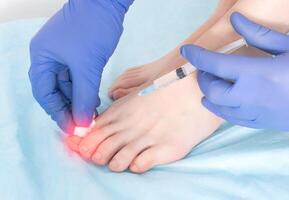 The doctor makes an injection in the joint of the toe for arthrosis, swelling and inflammation in the joint. Concept of joint regenerating injections with ozone-oxygen mixture, ozone therapy, modern photo