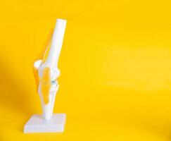 Knee joint mockup on yellow background. Concept of knee arthroplasty with implants. Copy space for text, replacement photo