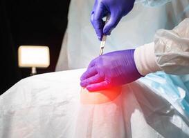 Doctor's hands with a scalpel near the patient's sore knee in the operating room. Knee replacement concept, arthroplasty photo