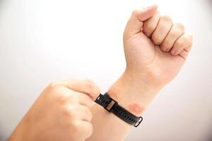 A man tightens a fitness bracelet with a silicone strap on his wrist, close-up. Concept of allergy and skin irritation from silicone watch strap, dermatitis. Copy space for text photo
