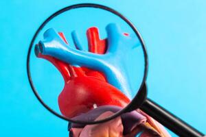 Coronary vessels of the heart under a magnifying glass on a blue background. Concept of examining heart vessels with coronary angiography, atherosclerosis. Close-up photo