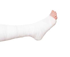 Leg bandaged in a tight dressing, plaster cast for fracture of the leg and ankle joint, isolate photo