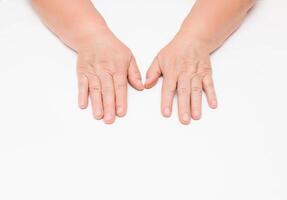 Dry skin with wrinkles on the hands of an elderly woman, white background, isolate. Fragility of blood vessels, vitamin deficiency, copy space photo