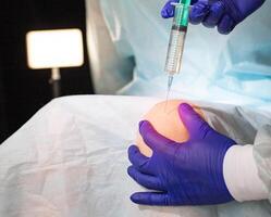 The doctor makes a therapeutic intra-articular injection into the knee joint to relieve inflammation and pain. Therapeutic injections of chondroitin and glucosamine, the introduction of hilauric acid photo