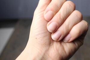 Female fingers close-up with nails without manicure. Hand and nail care photo