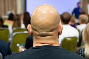A bald man is sitting peacefully in front of a group of people photo