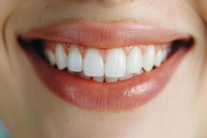 close up of a smiling mouth with white teeth photo