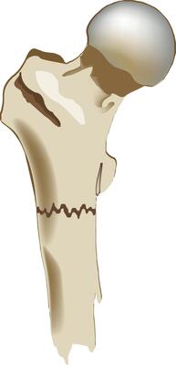 The shoulder joint is shown in this illustration