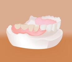 A tooth with a missing tooth and a missing tooth vector