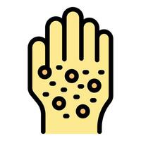 Hand showing symptoms of monkeypox infection with blisters and rashes vector