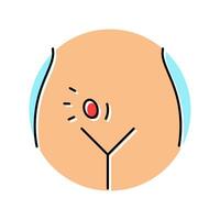 inguinal herniorrhaphy surgery color icon illustration vector