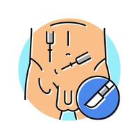 excisional biopsy surgery color icon illustration vector
