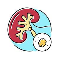 urolithiasis urology color icon illustration vector
