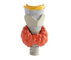 Hyperthyroidism, Overactive Thyroid, Thyroid Lymphoma isolated on white background with clipping path. photo
