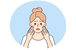 Sad woman with dry reddened eyes due to irritation or allergic reaction caused by food vector