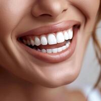 Close up of a smiling womans face with perfect teeth photo