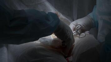 Close up of professional surgeons cauterizing an open wound during medical procedure. Action. Doctors in clean uniform using professional equipment. video