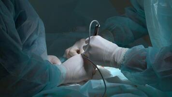 Close up of hands of surgeons team during operation with surgical laparoscopy instruments. Action. Team of surgeons at work in a hospital. video