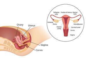 Examination of the uterus using transvaginal ultrasound. Scheme vector