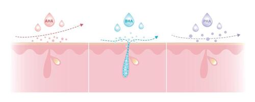 Comparison of Alpha, Beta, Poly Hydroxy Acids characteristics illustration. AHA exfoliate the surface skin. BHA penetrate deep into the pore. PHA dissolve the surface, large molecule, penetrate less. vector