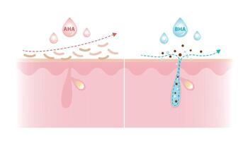 Alpha Hydroxy Acids and Beta Hydroxy Acids characteristics illustration on white background. AHA exfoliate the surface skin and water soluble. BHA penetrate deep into the pore and oil soluble. vector
