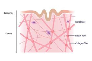 Cross section of low density of collagen, elastin fibers and fibroblasts in the dermis layer illustration on white background. Formation of aging and wrinkled. Skin care and beauty concept. vector
