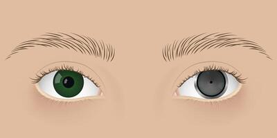 Human cyborg with camera inside one eye. Realistic photographic equipment instead of eyeball vector