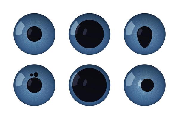 Eye pupils set with disease. Normal, anisocoria, colomba, polycoria, mydriasis corectopia