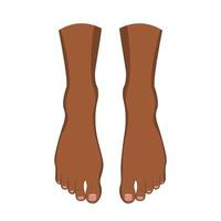 Hallux valgus problem. Orthopedics bunion health vector