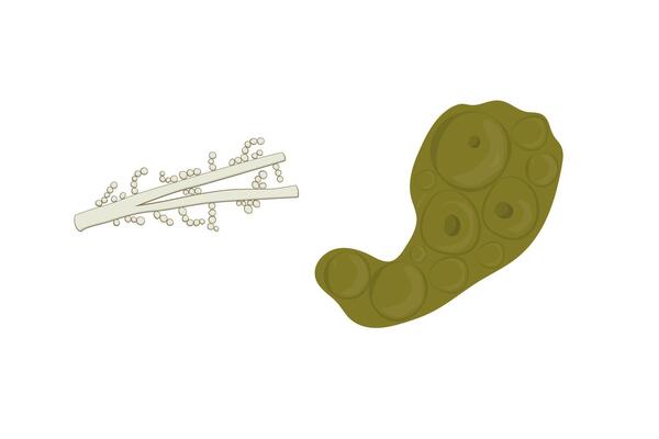 Wallemia mold illustration isolated on white background. Fungus realistic and schematic drawing design