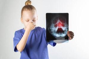 The girl holds an x-ray of the maxillary sinuses in her hands and holds her nose. Concept of inflammation of sinusitis and sinusitis in children, treatment, infectious photo
