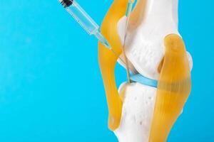 Intra-articular injection of anti-inflammatory medication into a mock-up knee joint on a blue background. The concept of drug blockade to relieve pain and inflammation. Copy space for text photo