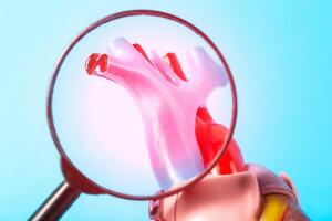 Inflamed coronary arteries of the heart under a magnifying glass on a blue background. Concept of atherosclerosis of the coronary arteries of the heart, risk of heart attack and angina, close-up photo